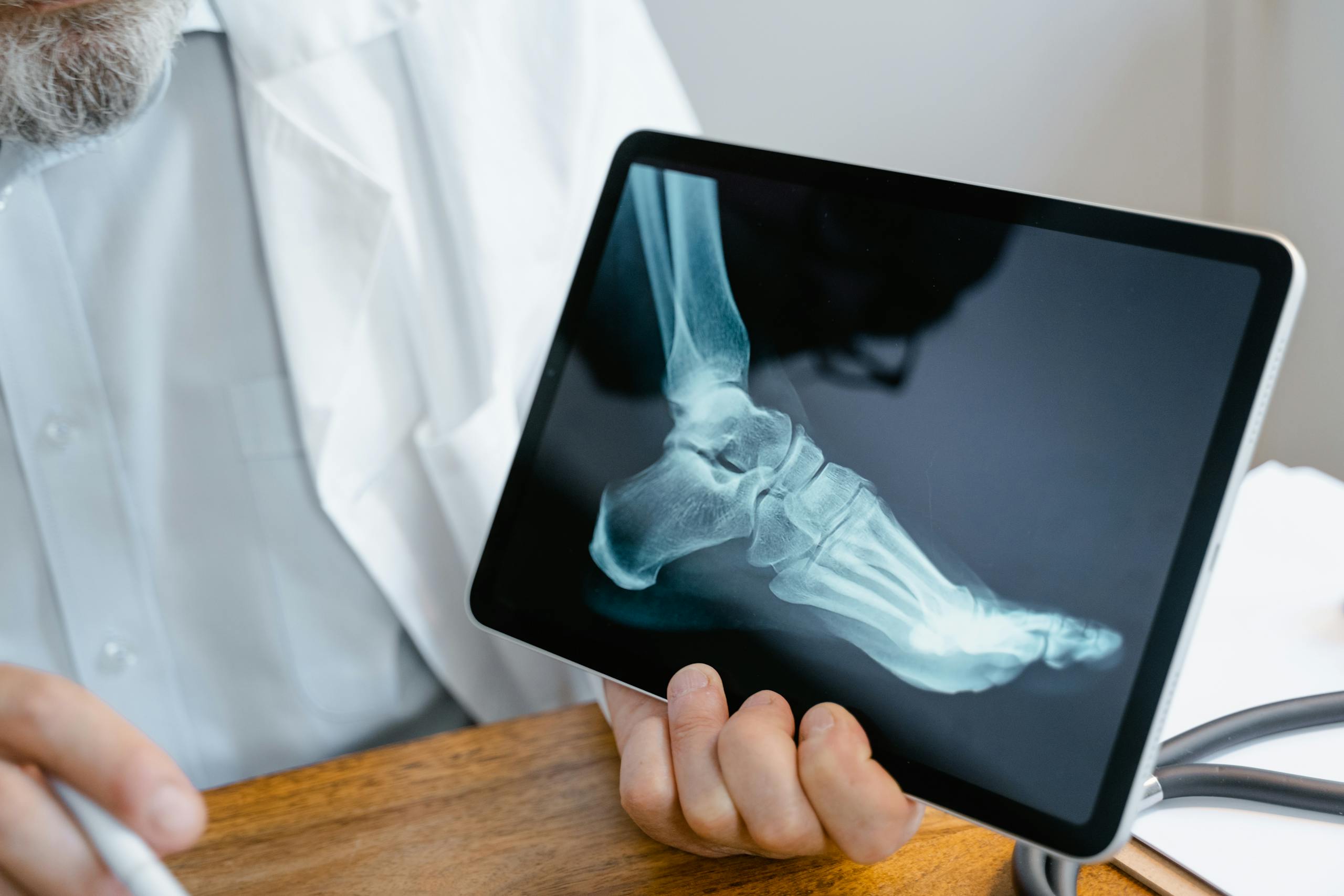 A doctor examines an x-ray image of a foot displayed on a tablet.